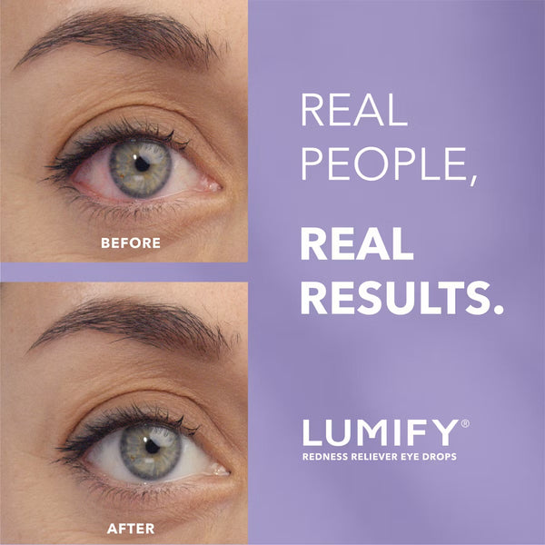 PREVENTA - Lumify Eye Drops for Redness Relief - 2.5ml