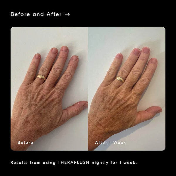 PREVENTA- Theraplush “Hold” Refillable Overnight Retinol Hand Repair Cream