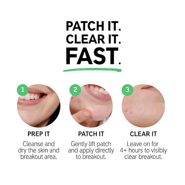 Hydrocolloid Invisible Pimple Patches