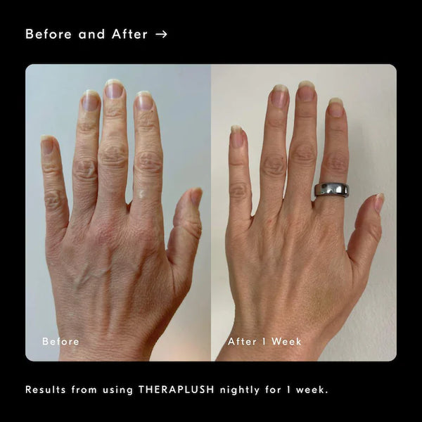 PREVENTA- Theraplush “Hold” Refillable Overnight Retinol Hand Repair Cream